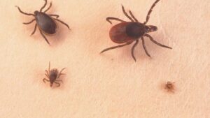 Heboh Virus ‘Tick-Borne’ di China, Begini Cara Penularan dan Gejalanya