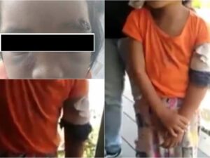 Bocah Perempuan 5 Tahun Babak Belur dan Patah Tangan, Disiksa Ibu Kandung dan Ayah Tirinya
