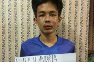 Info Terkini dari Polisi Soal Pengakuan Pelaku Penusukan Syekh Ali Jaber, Oh Ternyata