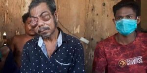 Kisah Pilu Kakek Mauria, Tak Bisa Melihat karena Matanya Digigit Serangga, Butuh Biaya Berobat