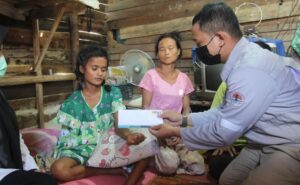 Miris, Siswa SD di Pekanbaru Harus Kehilangan Tangan saat Membantu Orang Tua