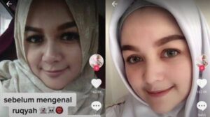 Kisah Wanita Viral Mengaku Wajahnya Glowing Berkat Ruqyah