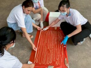 Ngeri! Cacing Pita Sepanjang 59 Kaki Keluar dari Dubur Pria Ini