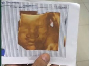 Viral Janin Meninggal Dunia di Dalam Kandungan karena Ibu Minum Rumput Fatimah