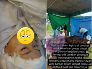 Polisi Bongkar Makam dan Otopsi Jenazah Agitha, Karena Ibunya Curiga Ada yang Tak Wajar