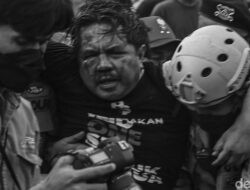 Kondisi Terkini Ade Armando yang Alami Pendarahan Otak-Kandung Kemih