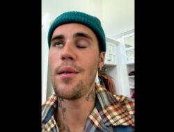 Justin Bieber Tunda Konser karena Wajahnya Lumpuh Sebelah